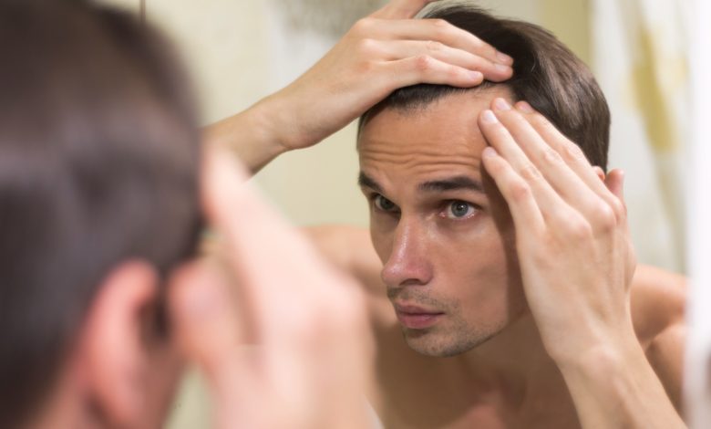 Pérdida del cabello en los hombres / caída del cabello