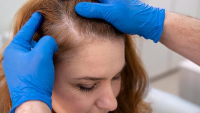 mujer recibiendo un tratamientos para la caída del cabello en una clínica