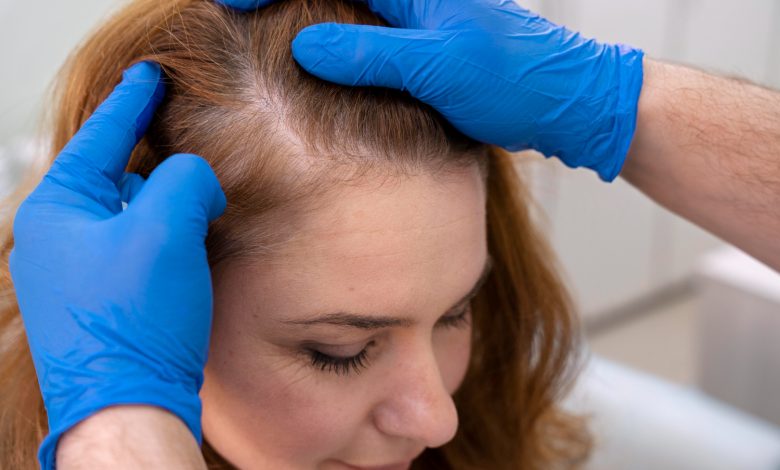 mujer recibiendo un tratamientos para la caída del cabello en una clínica