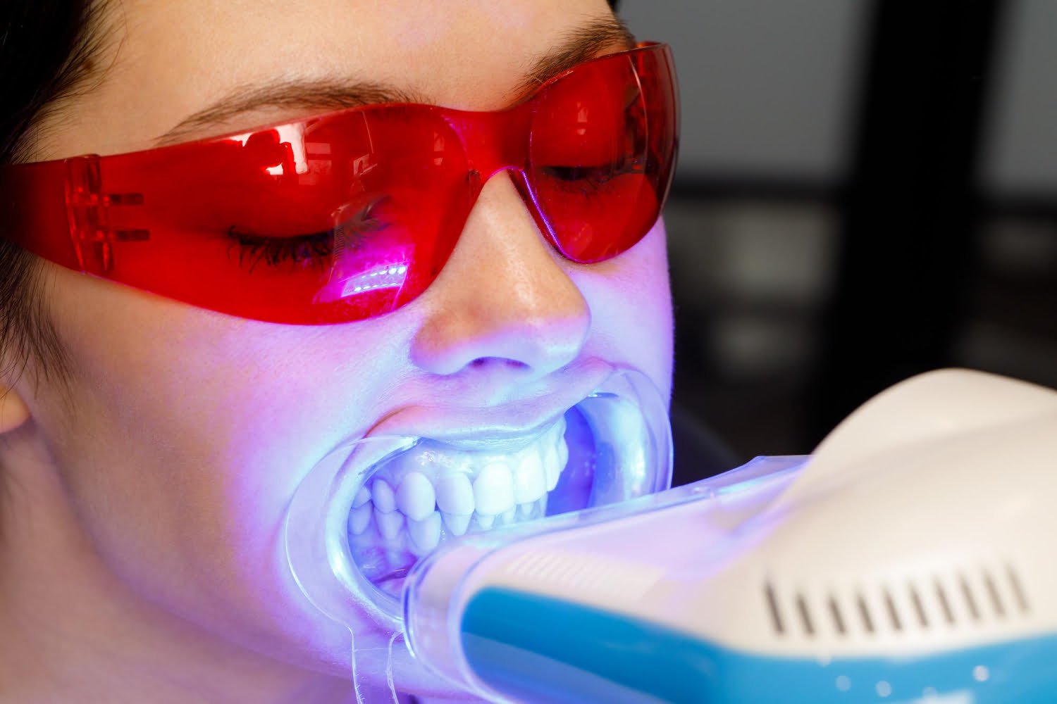 Blanqueamiento Dental Led Ventajas Desventajas Y Cuidados 