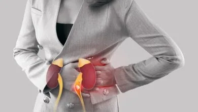 Insuficiencia renal crónica: síntomas y cómo prevenirla - cálculos renales