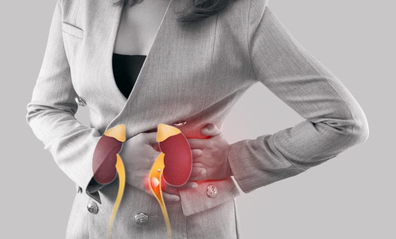 Insuficiencia renal crónica: síntomas y cómo prevenirla - cálculos renales