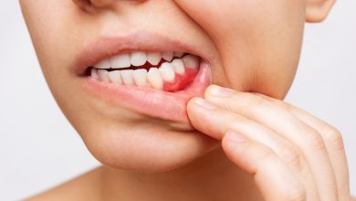 Cómo revertir la gingivitis y mejorar su salud bucal